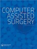 Computer Assisted SurgeryпԺօ^